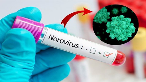 الآثار الجانبية لرفع قيود كورونا: تفشي فيروس جديد أشد عدوى!