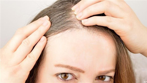 هكذا تتعاملين مع الشعر الأبيض