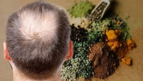 3 أعشاب تكافح تساقط الشعر