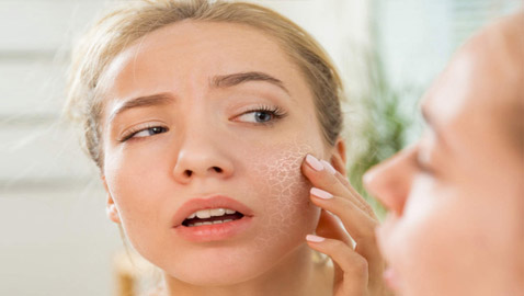 تعرفوا إلى أهم أسباب البشرة الجافة وكيفية حمايتها في فصل الشتاء