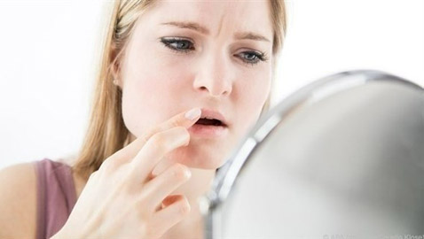 تشقق زوايا الفم...أكبر من مجرد مشكلة جمالية