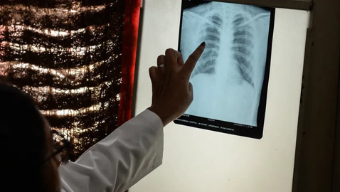 لا يقل خطرا عن كورونا.. خبراء يحذرون من إهمال 