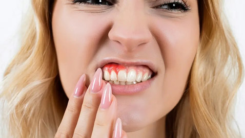 إياكم إهمال صحة الفم.. دراسة تكشف مفاجأة مدوية!