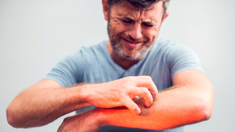 تعاني من الحكة المفاجئة أو طفح جلدي؟ هذه الأطعمة قد تكون السبب..!