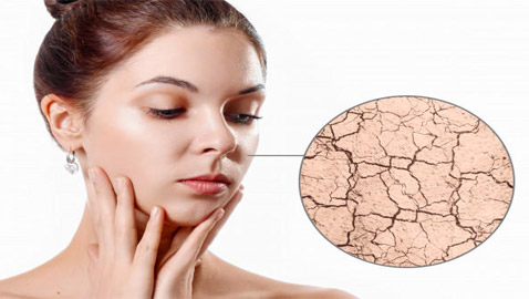 إليك طرق فعالة لعلاج جفاف الوجه الشديد في شهر رمضان