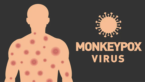 6 نصائح بسيطة.. هكذا تحمي نفسك من جدري القردة