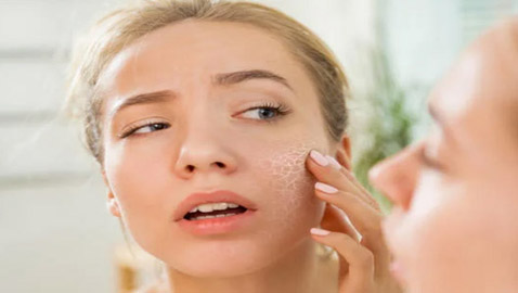 إليكم ماسك لعلاج مشاكل البشرة الجافة قبل العيد