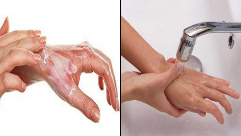 المعجون والثلج.. أخطاء شائعة عند الإصابة بالحروق تزيد الخطر