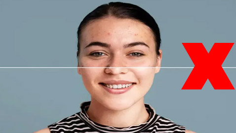 المعاناة من حب الشباب والبثور.. 5 أخطاء شائعة نرتكبها!