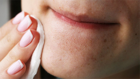 كيفية التخلص من الرؤوس السوداء على الذقن..؟