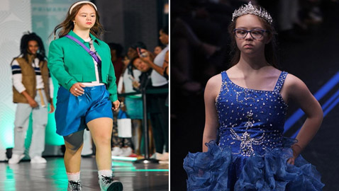 مراهقة مصابة بمتلازمة 