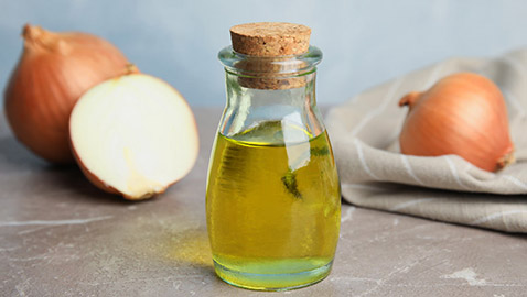 يعالج تساقط وتلف الشعر.. فوائد مذهلة لزيت البصل وطرق تحضيره بالمنزل