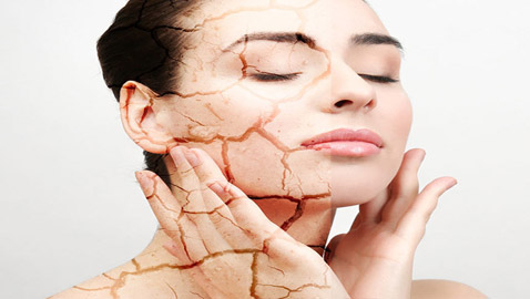 قللوا عدد مرات الاستحمام.. أسباب جفاف الجلد وطرق علاجه