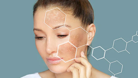 ما المكونات التي أثبتت فعاليتها في علاج البقع الداكنة؟