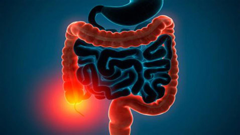 أفضل العصائر لتخفيف أعراض التهاب القولون التقرحي