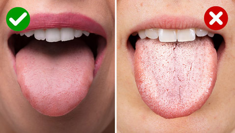 لسانك مرآة صحتك العامة.. إليك الأسباب والأعراض لوجود مشاكل