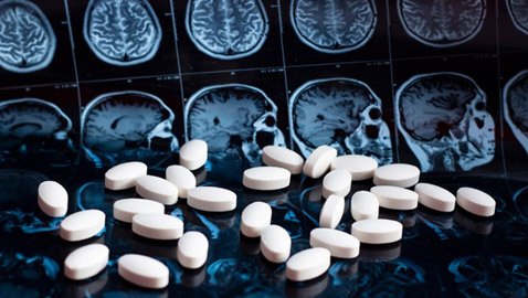 ضوء أخضر وموافقة نهائية على أول دواء يبطئ تطور مرض الزهايمر