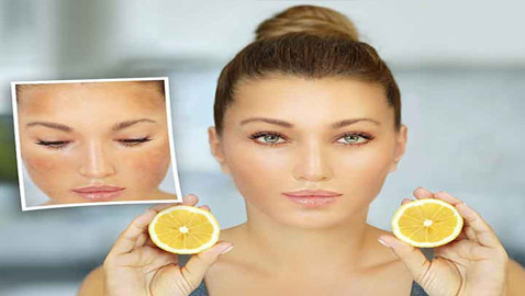 هذه أغرب المكونات المزيلة للبقع الداكنة.. هل تعرفونها؟